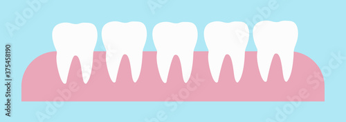 5 healthy teeth on the gums. Whitening teeth result
