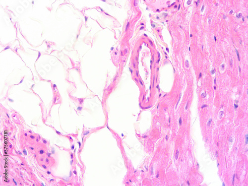 picture of histology human tissue with microscope from laboratory (not Illustration Designation)