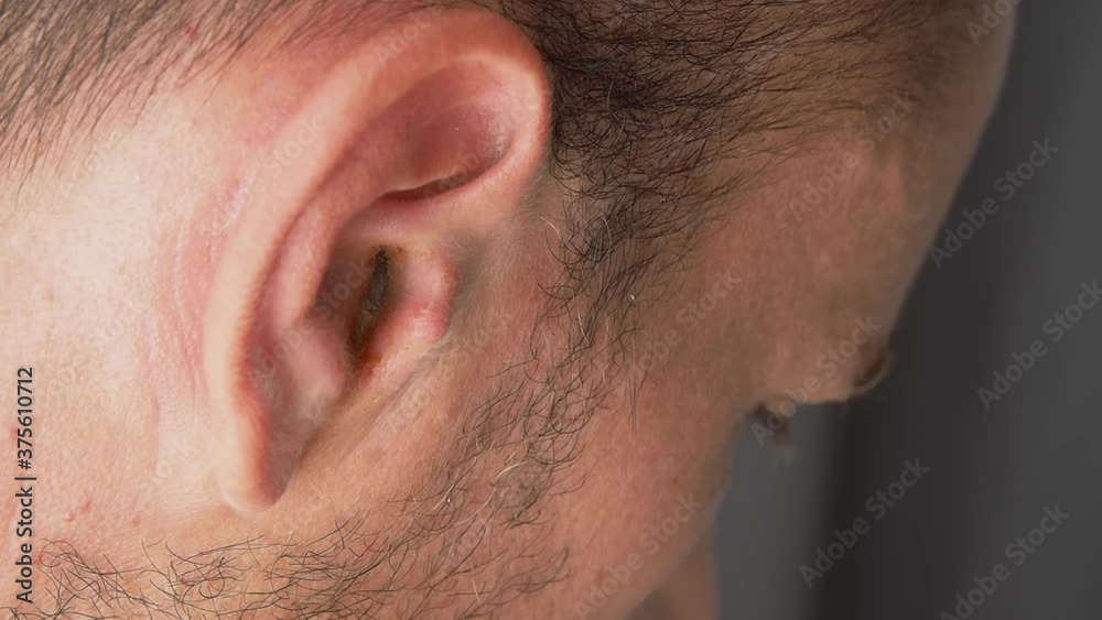 Man holding his aching ear, suffering from otitis, sudden hearing loss. Man holding his aching ear, suffering from otitis, sudden hearing loss.