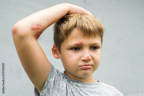 Portrait of young boy with wound on his face. Gray background. A scratch on the skin after a child falls. photo