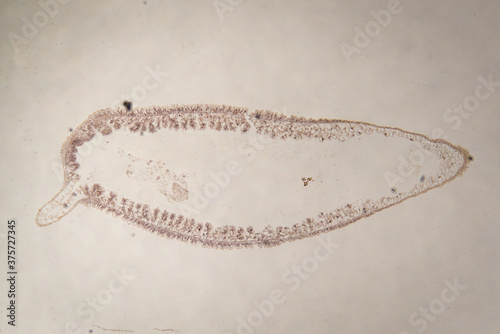 Hydra, L.S. Micrograph. photo