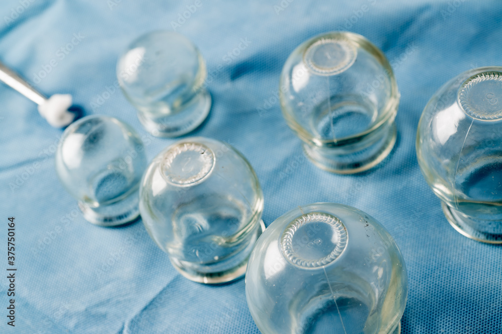cups of glass cupping therapy cups of glass cupping therapy