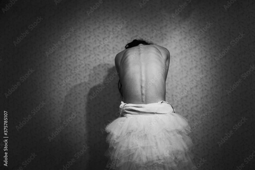 Skinny naked girl with visible spine bones Stock Photo Adobe Stock