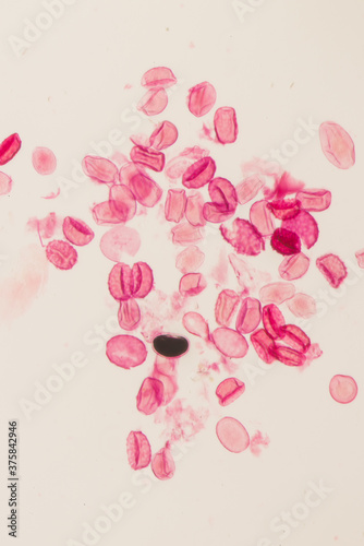Eggs of the parasite roundworm photo