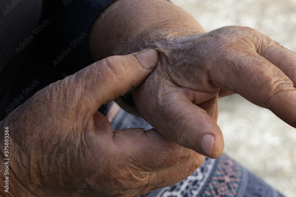 Fototapeta premium Elderly woman suffering from hand pain. Arthritis symptoms.