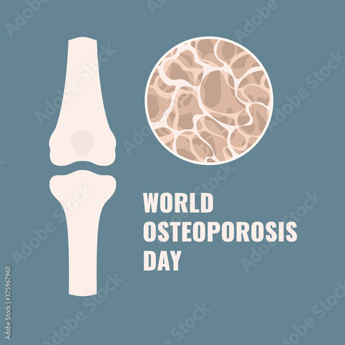 Osteoporosis awareness poster. Porous bone losing tissue. Spongy femur cavity with osteopenia. Hips, spinal fractures, broken bones prevention. Skeletal system disease. Medical vector illustration.