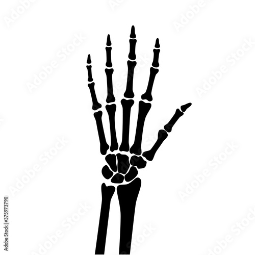 Arthrits x ray