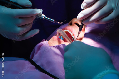 Dentist and assistant operating for checking, Teeth cleaning and doing dental scaling at dental clinic, Tooth care concept.