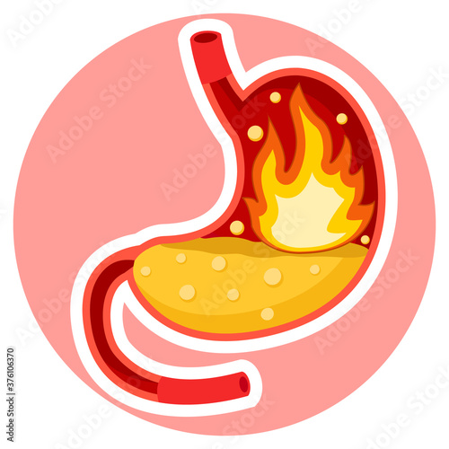 Heartburn in the stomach of a man on a white
