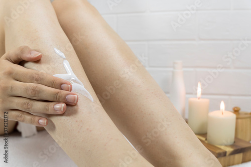 A woman applies a moisturizer to the skin of her legs. Problem skin  strawberry legs  chicken skin  hyperkeratosis  keratosis pilaris. Irritation after hair removal. Ingrown hairs. Skin care at home