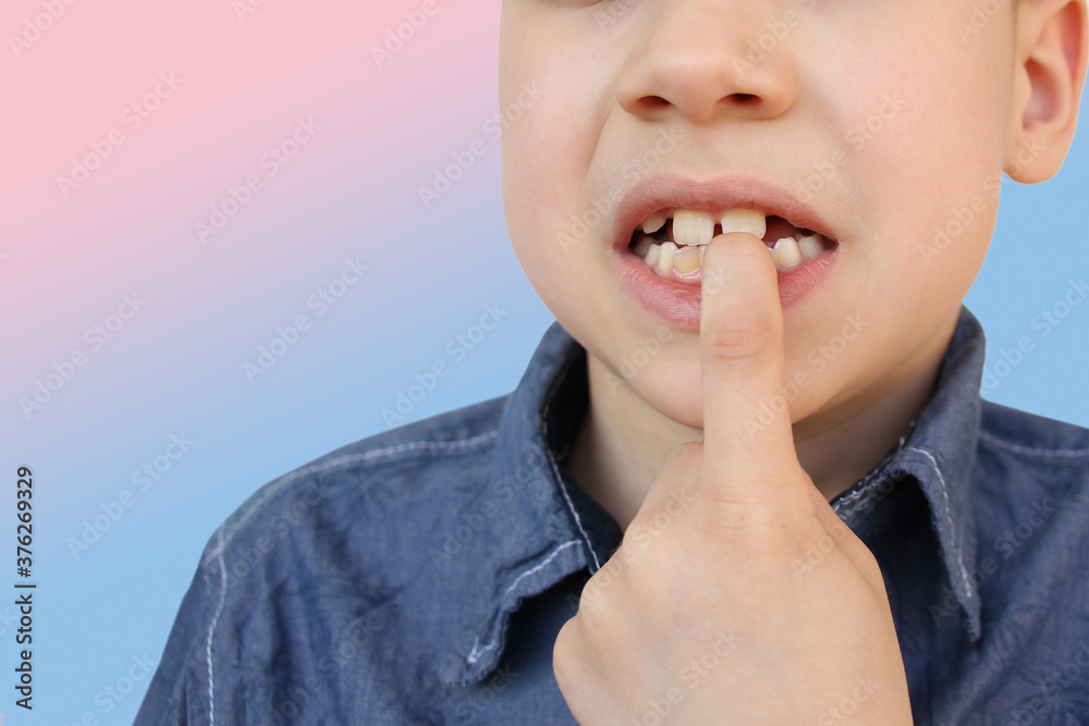 boy, kid nibbles and bites a nail on his hand, close-up, the concept of psychological disorder, stress, bad childhood habits boy, kid nibbles and bites a nail on his hand, close-up, the concept of psychological disorder, stress, bad childhood habits