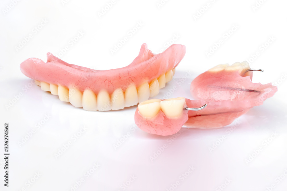 Acrylic dentures isolated on white background. Removable dentures flexible. False teeth. Acrylic dentures isolated on white background. Removable dentures flexible. False teeth.