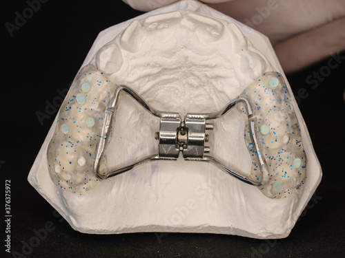 Appliance to make young upper jaw wider photo