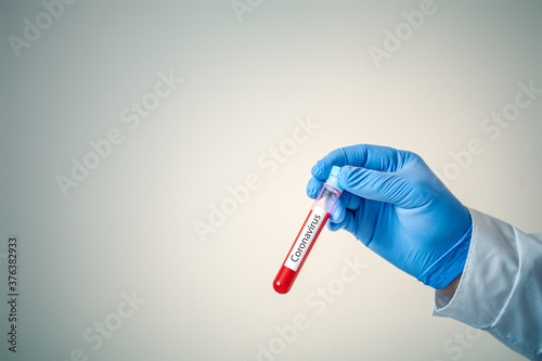 The epidemic of coronavirus. Hand of a doctor holding a bottle of blood sample.