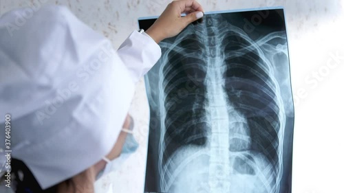 X-ray of the lungs in the hands of the doctor,the attending physician points his finger at the X-ray of the lungs to study the disease.Close-up.Pulmonary edema,pneumonia.