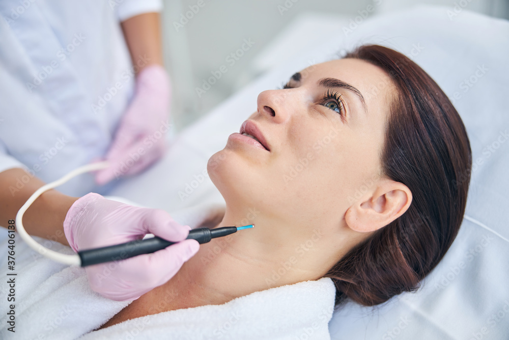 Cosmetician using an electrocautery machine for removing a nevus Cosmetician using an electrocautery machine for removing a nevus