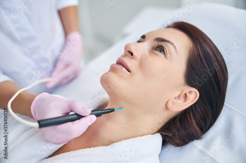 Cosmetician using an electrocautery machine for removing a nevus