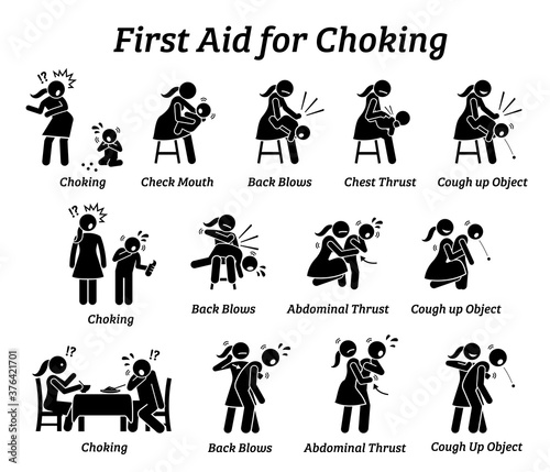 First aid emergency treatment for choking stick figures icon. Vector illustrations of baby, child, and adult choking while getting rescued with Heimlich Maneuver method. photo