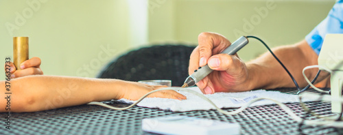 Vegetative rezonans diagnostic. Doctor examines child boy hand with the help of bioresonance dipstick tester, reveal disease causing bacteria via electromagnetic fields based on biofeedback principle
