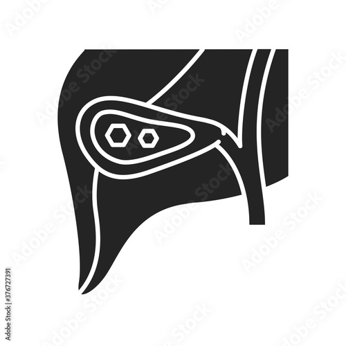 Pancreatic stones black glyph icon. Acute pancreatitis. Human organ concept. Sign for web page, mobile app, button, logo. Vector isolated element.