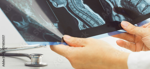 Female doctors hand pointing at x-ray or MRI medical imaging with a head and neck condition. Spinal cord  blood vessels. Neuro medicine. Healthcare and medicine. Injury. Bone tissues. Banner