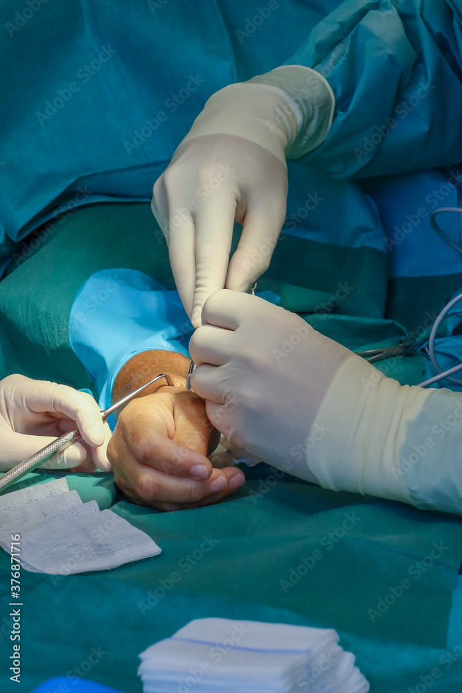 plastic surgeon performs hand surgery on a patient in an operating room