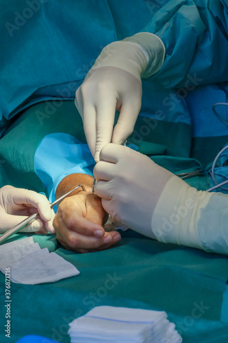  plastic surgeon performs hand surgery on a patient in an operating room