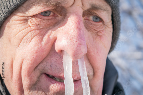 Portrait of an elderly man with icicles in his nose. The man's snot was frozen in his nose. Runny nose in the winter forest. Frosty weather in winter. Comic concept of a winter cold.