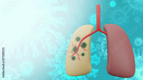 Viral infection of Coronavirus or COVID-19 in the lungs. Isolate on blurred background. Pandemic medical health risk concept with disease cell. 3d rendering illustration.