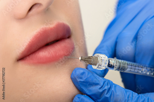 cosmetologist making injection in face, lips.