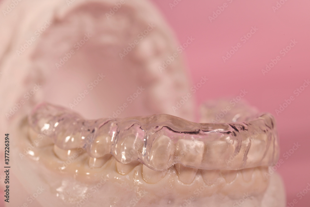 dental splint for bruxism Stock Photo Adobe Stock