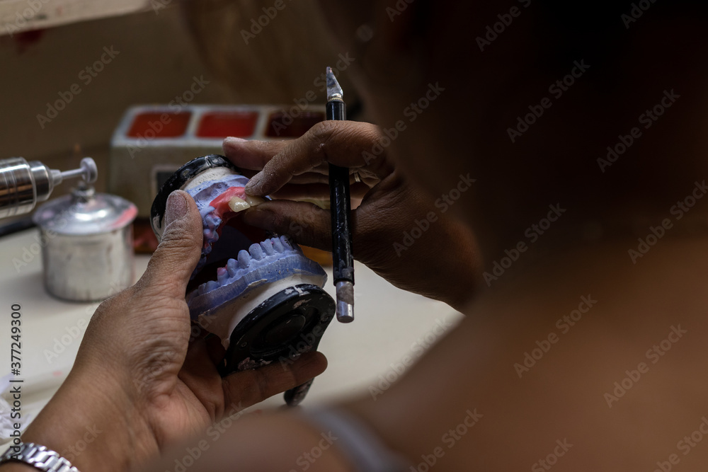 Over shoulder woman working with a prosthetic teeth Over shoulder woman working with a prosthetic teeth