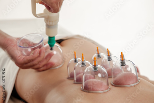 back massage with vacuum cups