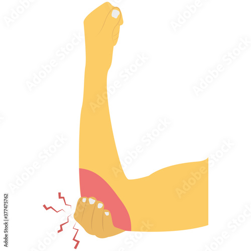Elbow Fractured 