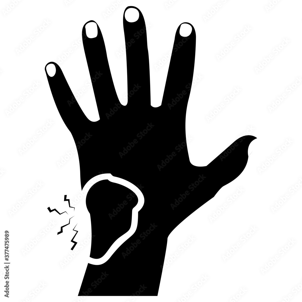 Fototapeta premium Hand Bleeding 