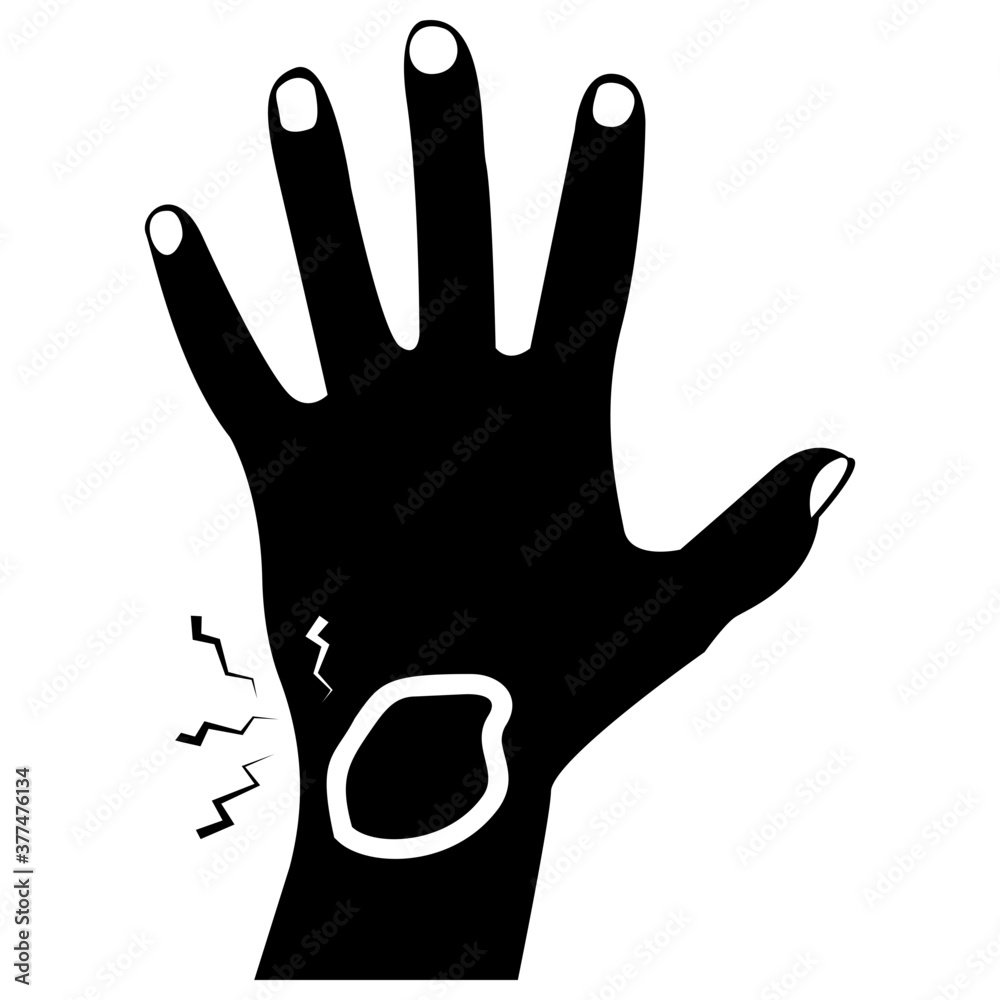 Fototapeta premium Hand Bleeding 