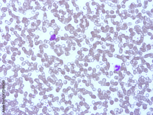 Histology of human tissue, show  epithelial tissue and connective tissue with microscope view  from laboratory (not Illustration Designation) photo