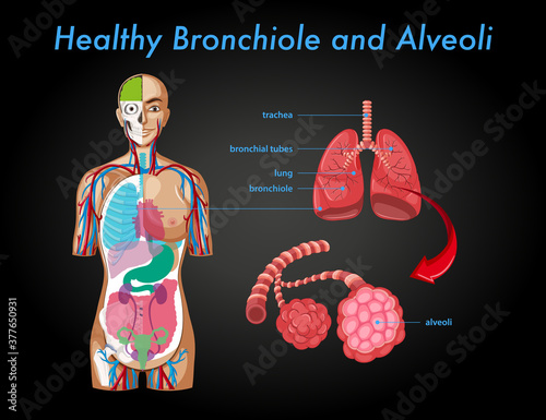 Healthy bronchiole and alveoli