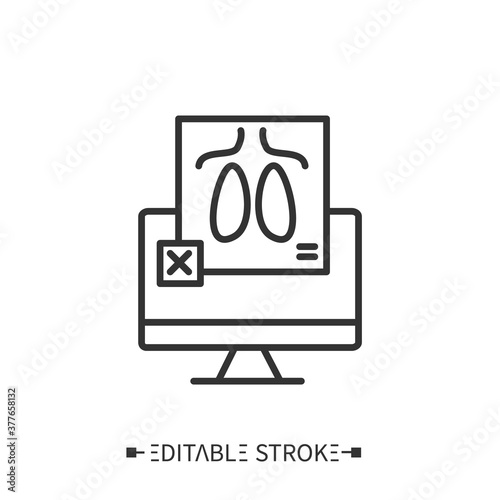 Computerized fluorography. Lungs examination.Tuberculosis prevention.Modern medicine equipment.Computerized tomography.X-ray diagnostics.Healthcare and health information management concept.Editable 