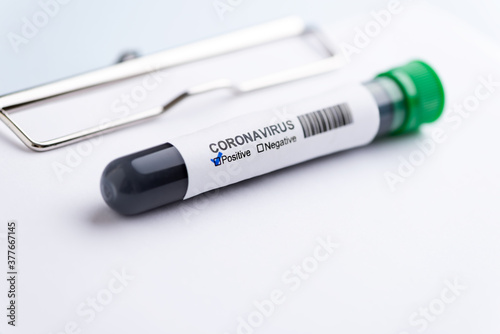Positive coronavirus test tube on clipboard. Coronavirus protection concept (COVID19).