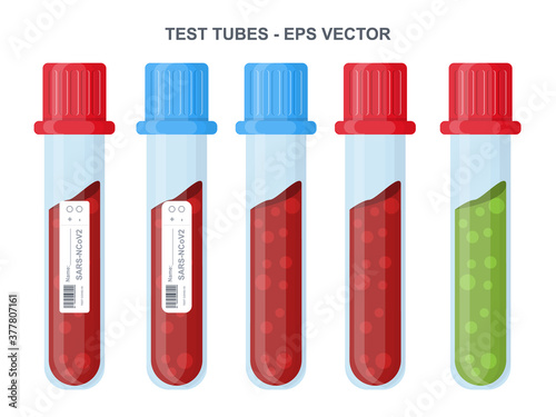 Tubes with blood test and laboratory vector concept