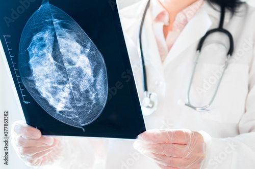 Female doctor looking at mammography results on x-ray