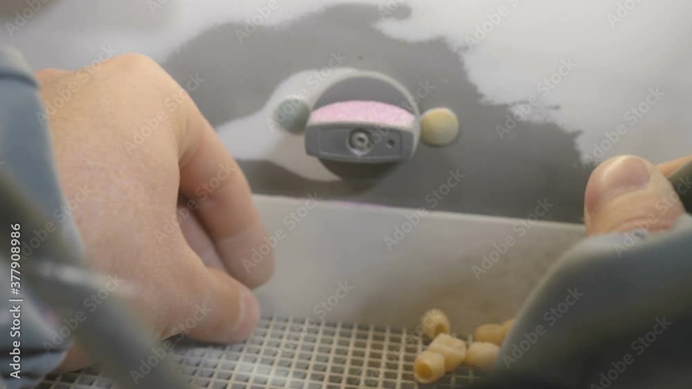 Dental prosthesis, artificial tooth, prosthetic. technician holding