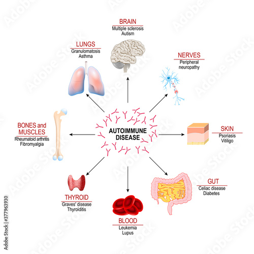 Tissues of the human body affected by autoimmune attack