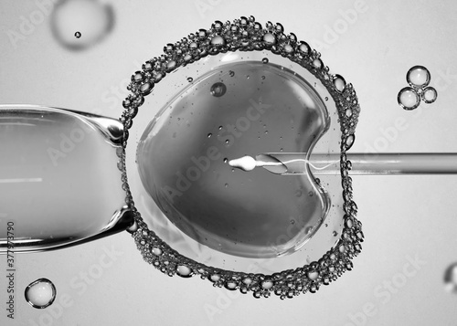 Ovum with needle and sperm for artificial insemination or in vitro fertilization. Concept of artificial insemination or fertility treatment. Image