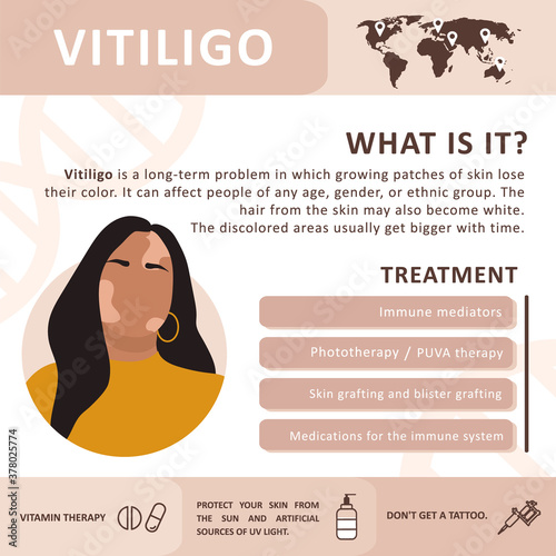 Infographics of vitiligo. Treatment the disease. Abstract woman silhouette. Vector concept to support people living with vitiligo and to build awareness about chronic skin disorder. Self care.