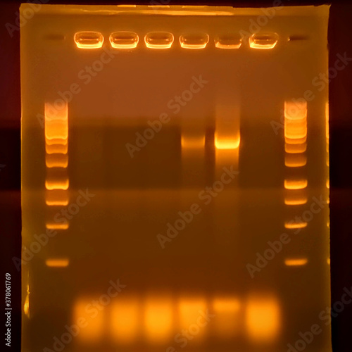 result of agarose gel electrophoresis of PCR products. separation of DNA fragments amplified with the PCR is used for genotyping of transgenic lines in search for heterozygeous lines with tDNA insert