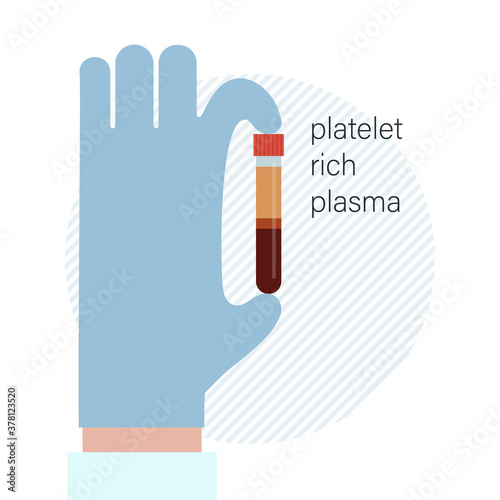 Doctor hand with platelet rich plasma tube. Separated blood for PRP hair and skin therapy. Medical laboratory equipment for PRP dermatology injection.