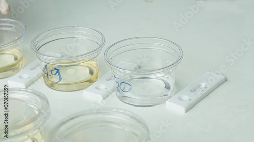 Several clear cups of urine were placed on the table, ready for the inspector to examine the narcotics contained in the urine.