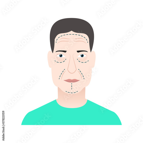Plastic surgery markers on face Vector illustration in flat style Isolated image of elderly white man with wrinkles in green t-shirt